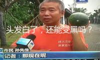 頭發(fā)白了，還能變黑嗎？醫(yī)師的答案出人意料
